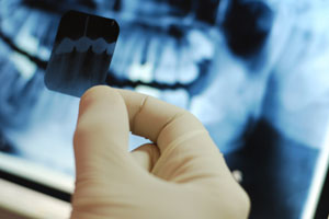 Dental X-rays